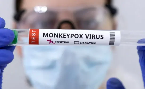 MC-Monkey-Pox_7