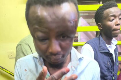 Ikanga Ward MCA, Cyrus kisavi after a mob altercation in Nairobi CBD