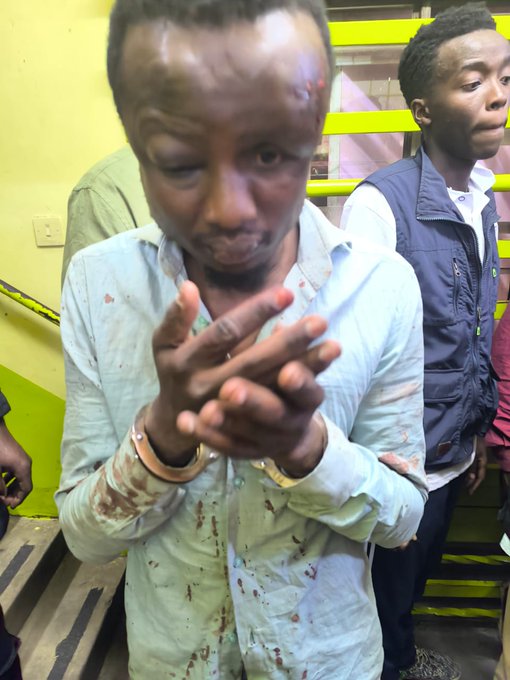 Ikanga Ward MCA, Cyrus kisavi after a mob altercation in Nairobi CBD