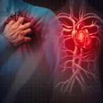 cardiovascular disease PHOTO| Sprint medical