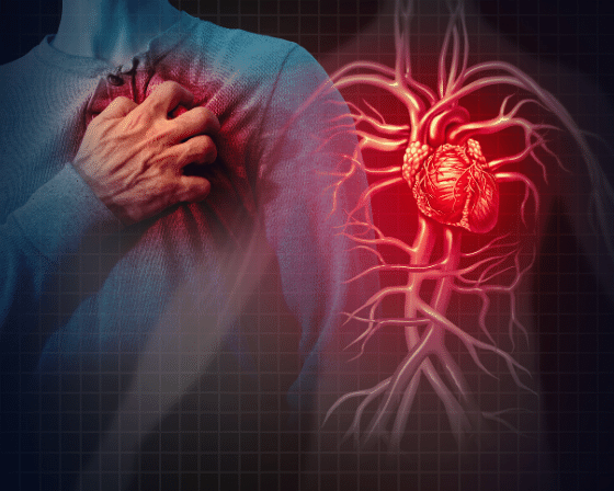 cardiovascular disease PHOTO| Sprint medical